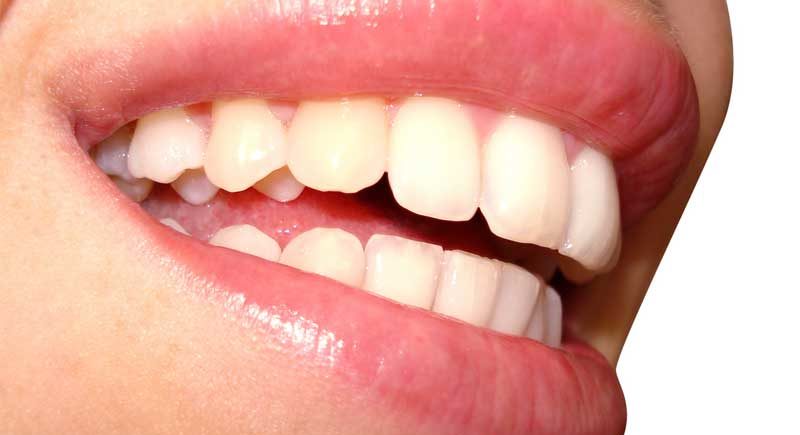 Oral Health