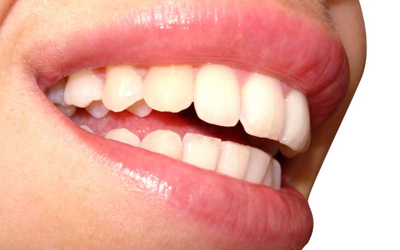 Oral Health