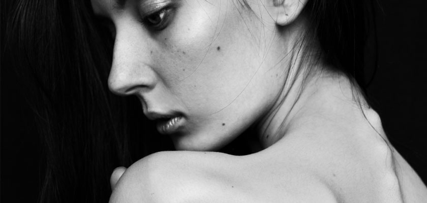 anorexic woman