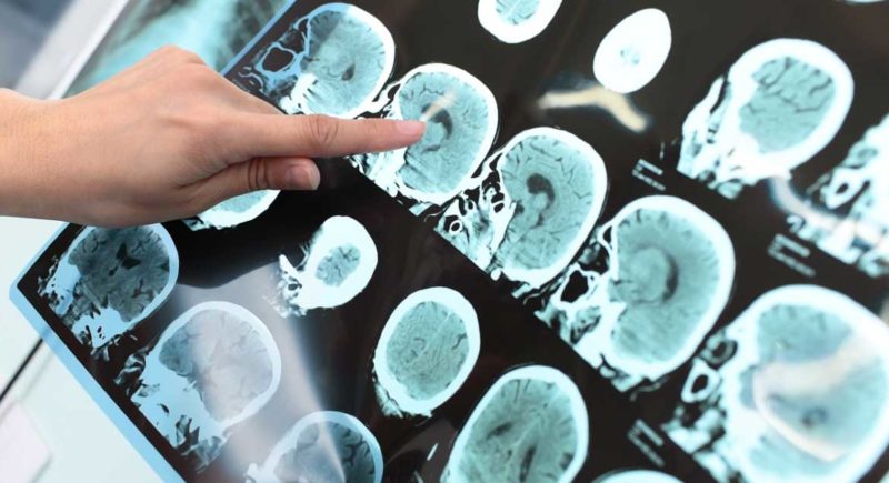The Brain, Relationships, and Love
