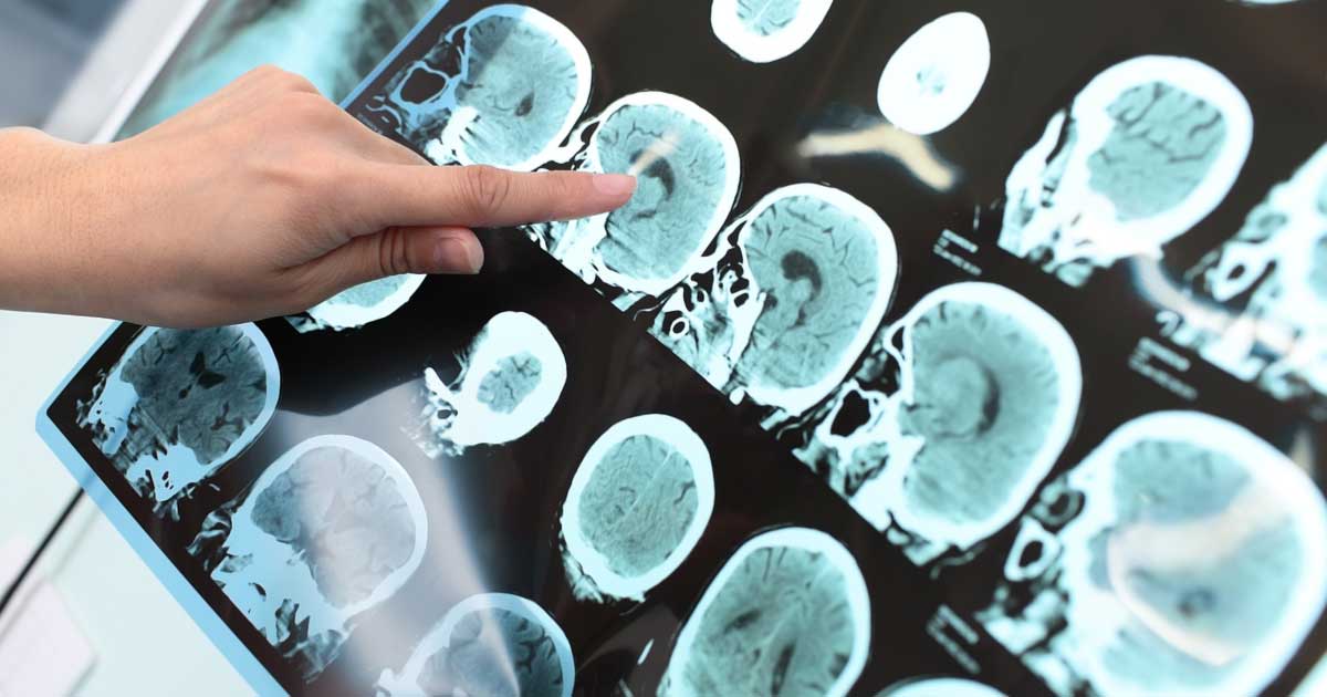 The Brain, Relationships, and Love